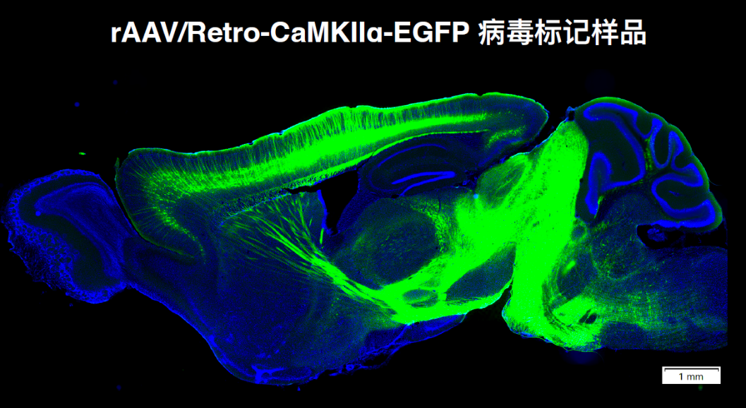 北京大学国家生物医学成像科学中心新置VISoR系统完成安装调试并投入使用 北京大学国家生物医学成像科学中心新置VISoR系统完成安装调试并投入使用