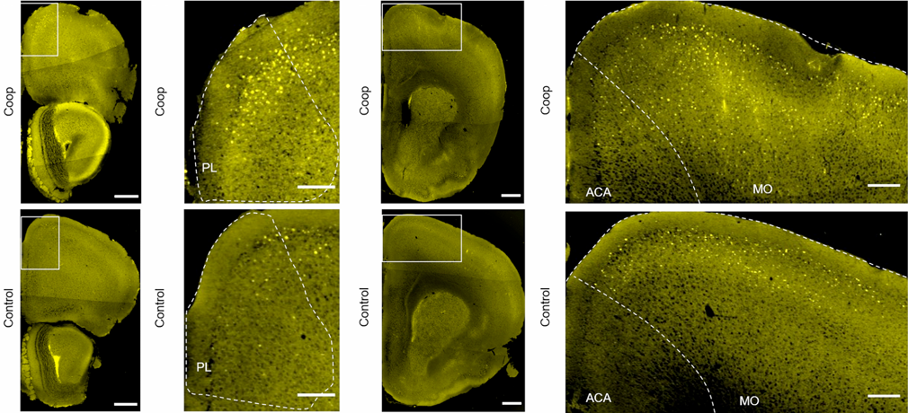 北京大学国家生物医学成像科学中心新置VISoR系统完成安装调试并投入使用 北京大学国家生物医学成像科学中心新置VISoR系统完成安装调试并投入使用