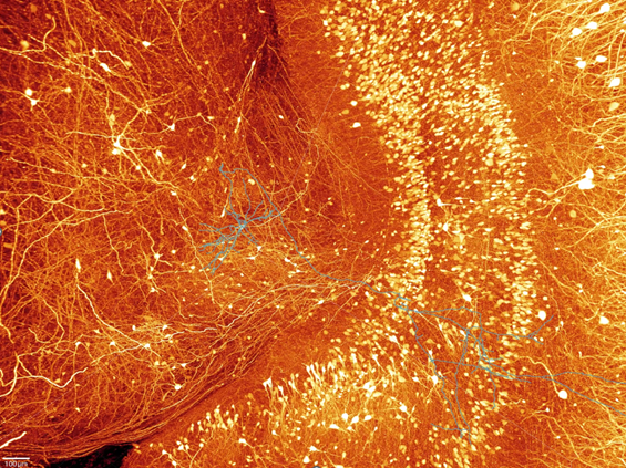 重磅科研速递 | 解密慢性疼痛神经环路，深圳百会新知Lychnis软件助力顶刊重大突破！